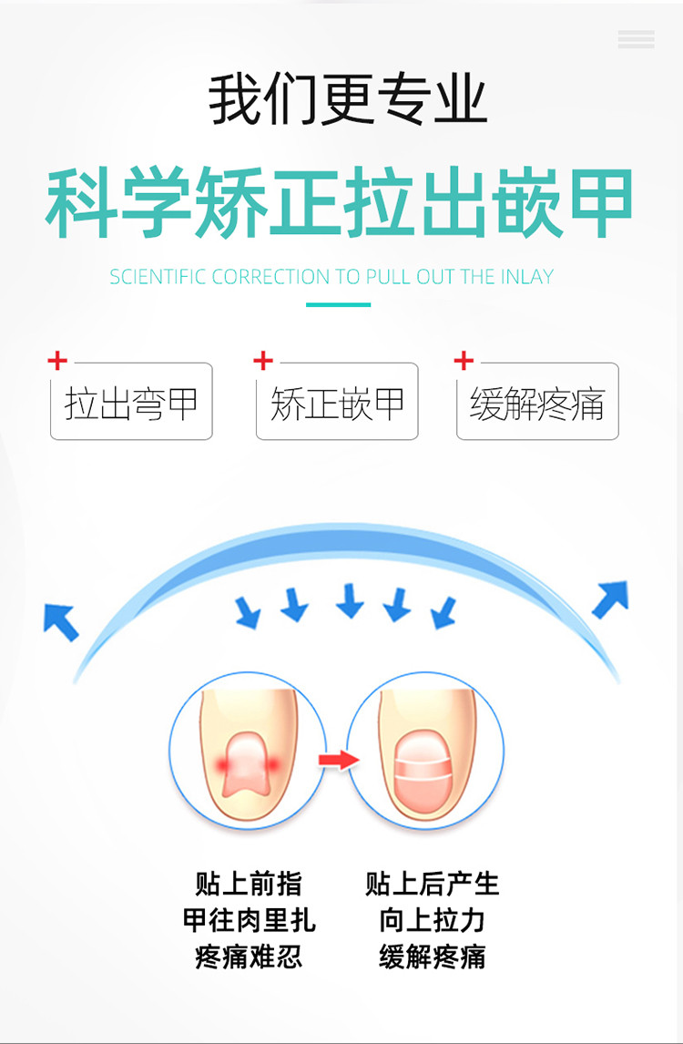 甲沟炎专用指甲刀正甲片拉脚趾甲矫正指甲长肉矫正药修脚甲沟炎