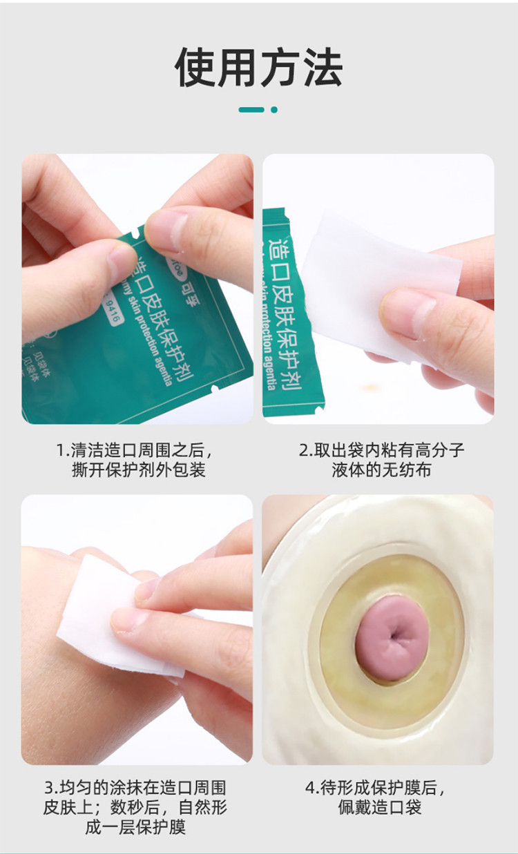 造口袋造口皮肤保护膜医用护理用品附件造瘘口医疗保护剂护肤
