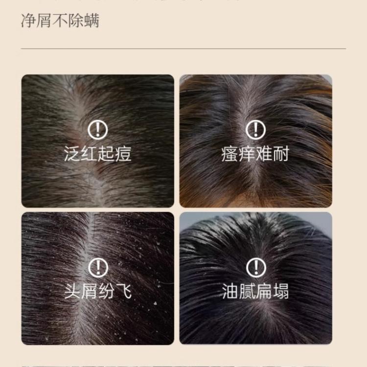 SACELLEC BEAUTE 进口去屑止痒洗发水二硫化硒控油蓬松改善毛躁除螨炎持久留香高级