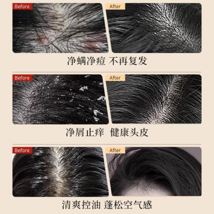 SACELLEC BEAUTE 进口去屑止痒洗发水二硫化硒控油蓬松改善毛躁除螨炎持久留香高级