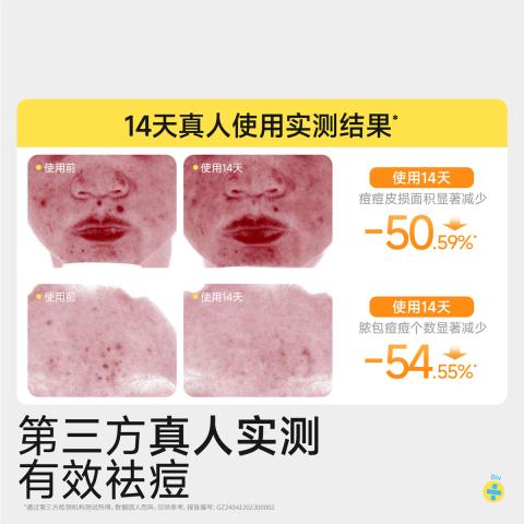 润本 【青少年洁面乳】控油祛痘青春期清洁祛黑头学生洗面奶国庆出游 图片 8