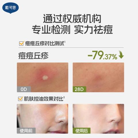 戴·可·思 【青少年修护2.0】修护乳补水保湿男女学生青春期乳液温和控油 图片 4