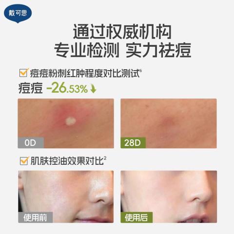 戴·可·思 【青少年护肤2.0】控油祛痘洗面奶水乳精华男女学生青春期套装 图片 4