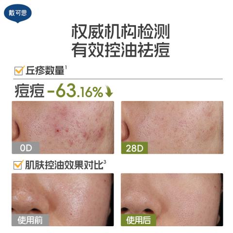 戴·可·思 【青少年控油面膜】青少年平衡调理面膜男女学生清洁保湿控油面膜 图片 4