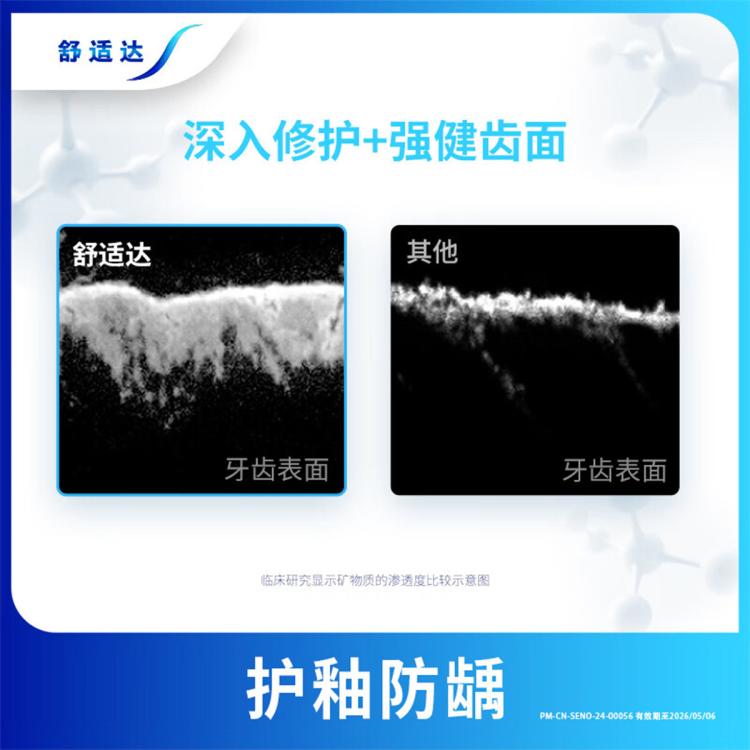 舒适达 【囤货装】3重护齿舒缓敏感牙膏减少出血呵护牙龈180g*4