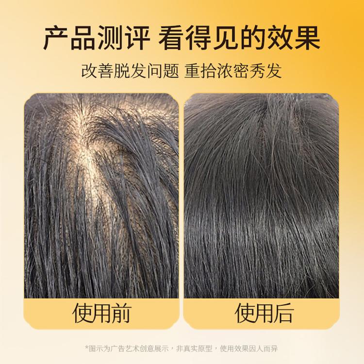 高缇雅 【明星升级款】控油蓬松去屑持证防脱生姜洗发水持久留香修护头皮